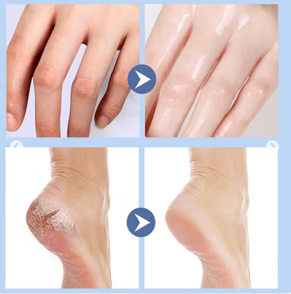 🦶 Suprema FootCare™ – Crème réparatrice intense pour pieds secs & talons fissurés