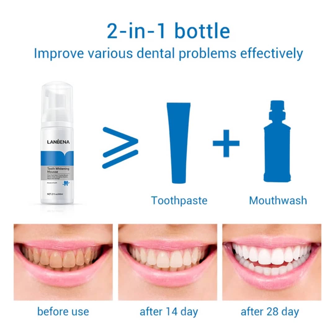 ✨ LANBENA Teeth Whitening Mousse – 60 ml