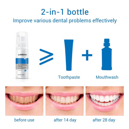 ✨ LANBENA Teeth Whitening Mousse – 60 ml